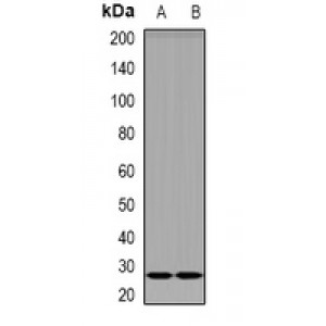 LifeSab™ DKK4 Rabbit pAb (50 µl)