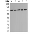 LifeSab™ PSD95 Rabbit pAb (50 µl)