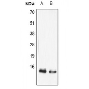 LifeSab™ FABP5 Rabbit pAb (50 µl)