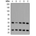 LifeSab™ CD16b Rabbit pAb (50 µl)