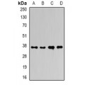 LifeSab™ Ficolin 1 Rabbit pAb (50 µl)