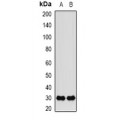 LifeSab™ FKBP3 Rabbit pAb (50 µl)