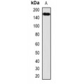 LifeSab™ VEGFR3 Rabbit pAb (50 µl)