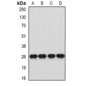 LifeSab™ HLA-DQA1 Rabbit pAb (50 µl)