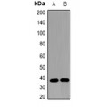 LifeSab™ Omentin Rabbit pAb (50 µl)