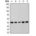 LifeSab™ MICA Rabbit pAb (50 µl)