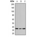 LifeSab™ Calsarcin 1 Rabbit pAb (50 µl)