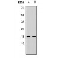 LifeSab™ PDCD5 Rabbit pAb (50 µl)