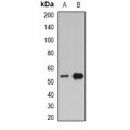 LifeSab™ Adipophilin Rabbit pAb (50 µl)