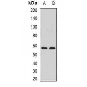 LifeSab™ CALNA3 Rabbit pAb (50 µl)