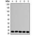 LifeSab™ RAB17 Rabbit pAb (50 µl)