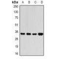 LifeSab™ RFC5 Rabbit pAb (50 µl)