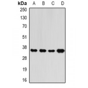 LifeSab™ RFC5 Rabbit pAb (50 µl)