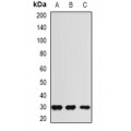 LifeSab™ RGR Rabbit pAb (50 µl)