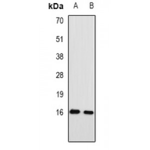 LifeSab™ RPA3 Rabbit pAb (50 µl)