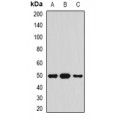 LifeSab™ Serpin A4 Rabbit pAb (50 µl)