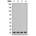 LifeSab™ SM22 alpha Rabbit pAb (50 µl)