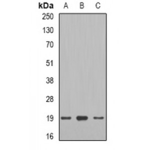 LifeSab™ Telethonin Rabbit pAb (50 µl)