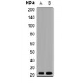 LifeSab™ TNNI2 Rabbit pAb (50 µl)