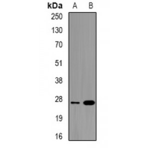 LifeSab™ ULBP2 Rabbit pAb (50 µl)