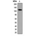 LifeSab™ Calpastatin Rabbit pAb (50 µl)