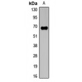 LifeSab™ cIAP2 Rabbit pAb (50 µl)