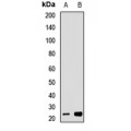 LifeSab™ Tim23 Rabbit pAb (50 µl)