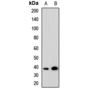 LifeSab™ TRIB1 Rabbit pAb (50 µl)