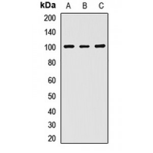 LifeSab™ Desmocollin 2 Rabbit pAb (50 µl)