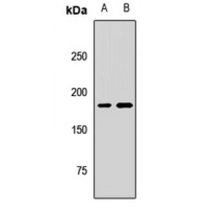 LifeSab™ KIF14 Rabbit pAb (50 µl)