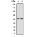 LifeSab™ P4HA1 Rabbit pAb (50 µl)