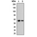 LifeSab™ BACE1 Rabbit pAb (50 µl)