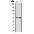 LifeSab™ SQSTM1 Rabbit pAb (50 µl)