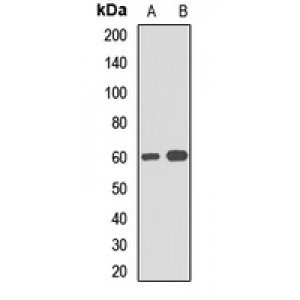 LifeSab™ SQSTM1 Rabbit pAb (50 µl)