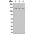 LifeSab™ CHAMP1 Rabbit pAb (50 µl)