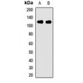 LifeSab™ PIBF Rabbit pAb (50 µl)