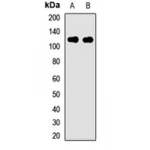 LifeSab™ PIBF Rabbit pAb (50 µl)