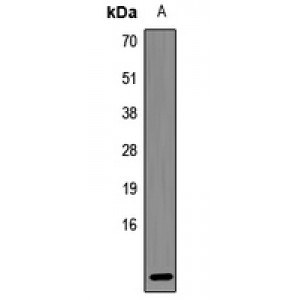 LifeSab™ Defensin beta 121 Rabbit pAb (50 µl)