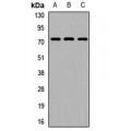 LifeSab™ RIOK2 Rabbit pAb (50 µl)