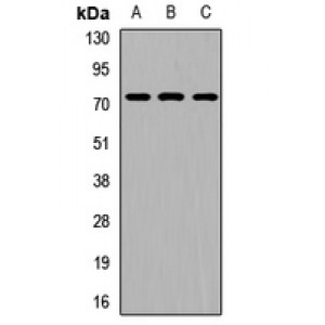 LifeSab™ RIOK2 Rabbit pAb (50 µl)