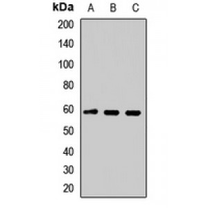 LifeSab™ TSPYL1 Rabbit pAb (50 µl)