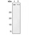 LifeSab™ CSMD3 Rabbit pAb (50 µl)