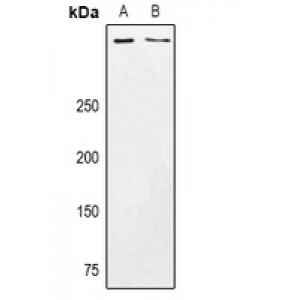 LifeSab™ CSMD3 Rabbit pAb (50 µl)