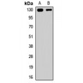 LifeSab™ CACNA2D4 Rabbit pAb (50 µl)