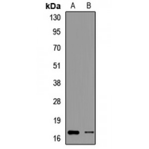 LifeSab™ PFDN2 Rabbit pAb (50 µl)