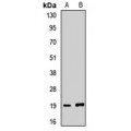 LifeSab™ Gemin6 Rabbit pAb (50 µl)