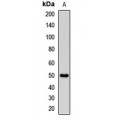 LifeSab™ CD162 Rabbit pAb (50 µl)