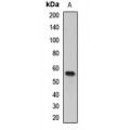 LifeSab™ c-FGR Rabbit pAb (50 µl)