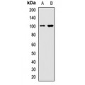 LifeSab™ BRD7 Rabbit pAb (50 µl)