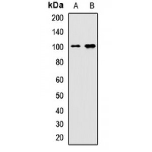 LifeSab™ BRD7 Rabbit pAb (50 µl)